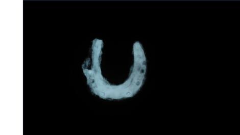 X-ray of horseshoe